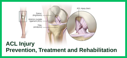 ACL Injury: Prevention, Treatment and Rehabilitation